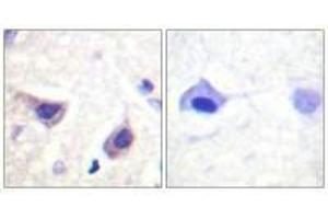 Immunohistochemistry analysis of paraffin-embedded human brain tissue using JAK3 (Ab-785) antiobdy. (JAK3 抗体  (Tyr785))
