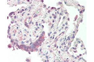 Human, Lung: Formalin-Fixed Paraffin-Embedded (FFPE). (DEGS1 抗体  (N-Term))