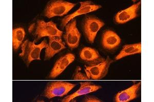 Immunofluorescence analysis of U20S cells using RIG-I / DDX58 Polyclonal Antibody at dilution of 1:100. (DDX58 抗体)