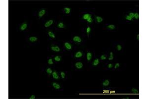 Immunofluorescence (IF) image for anti-Transducin (Beta)-Like 1 X-Linked Receptor 1 (TBL1XR1) (AA 81-178) antibody (ABIN566377)