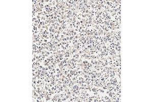 Immunohistochemistry (Paraffin-embedded Sections) (IHC (p)) image for anti-Sphingomyelin phosphodiesterase 1, Acid Lysosomal (SMPD1) (AA 391-419), (C-Term) antibody (ABIN656161)