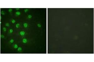 Immunofluorescence analysis of HuvEc cells treated with serum 20% 30', using p57 Kip2 (Phospho-Thr310) Antibody. (CDKN1C 抗体  (pThr310))
