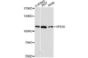 Western blot analysis of extracts of various cell lines, using VPS39 antibody. (VPS39 抗体  (AA 606-875))