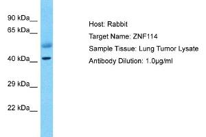 Host: Rabbit Target Name: ZNF114 Sample Type: Lung Tumor lysates Antibody Dilution: 1. (ZNF114 抗体  (C-Term))