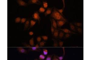 Immunofluorescence analysis of HeLa cells using Twist Polyclonal Antibody at dilution of 1:100. (TWIST1 抗体)