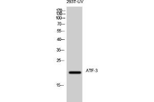 Western Blot analysis of 293T-UV cells using ATF-3 Polyclonal Antibody diluted at 1:500. (ATF3 抗体  (AA 100-180))