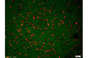 Formalin-fixed and paraffin-embedded rat brain labeled with Anti-Phospho-NMDAR2B (Tyr1070) Polyclonal Antibody, Unconjugated (ABIN744353) 1:200, overnight at 4°C, The secondary antibody was Goat Anti-Rabbit IgG, Cy3 conjugated used at 1:200 dilution for 40 minutes at 37°C.