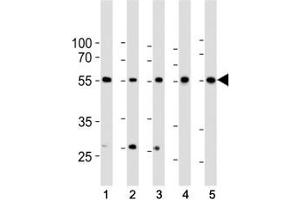 Western blot analysis of lysate from 1) HeLa, 2) K562, 3) MCF-7 cell line, 4) human liver and 5) mouse liver tissue lysate using BMPR1A antibody at 1:1000. (BMPR1A 抗体  (AA 1-30))