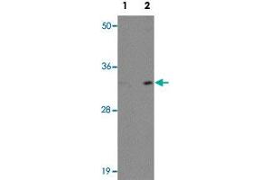 Western blot analysis of EL4 cells with INCA1 polyclonal antibody  at (Lane 1) 1 and (Lane 2) 2 ug/mL dilution. (INCA1 抗体  (C-Term))