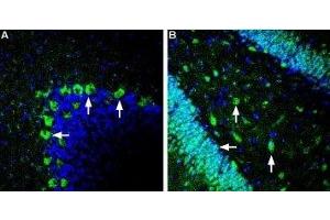 Immunohistochemistry (IHC) image for anti-Solute Carrier Family 2 (Facilitated Glucose Transporter), Member 2 (SLC2A2) (AA 496-508), (Intracellular) antibody (ABIN7043694)