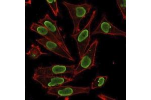 Immunofluorescence staining of PFA-fixed HeLa cells using Histone H1 Rabbit Polyclonal Antibody followed by goat anti-rabbit IgG-CF488 (green). (Histone H1 抗体)