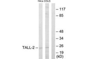 Western blot analysis of extracts from HeLa/COLO205 cells, using TALL-2 Antibody. (TNFSF13 抗体  (AA 151-200))