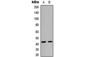 Western blot analysis of GPR54 expression in HEK293T (A), A549 (B) whole cell lysates. (KISS1R 抗体  (C-Term))