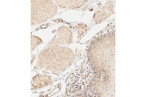 Immunohistochemical analysis of paraffin-embedded human esophagus tissue using (ABIN652257 and ABIN2841071) performed on the Leica® BOND RXm.