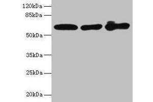 Western blot All lanes: KRT6A antibody at 4 μg/mL Lane 1: A431 whole cell lysate Lane 2: K562 whole cell lysate Lane 3: MCF-7 whole cell lysate Secondary Goat polyclonal to rabbit IgG at 1/10000 dilution Predicted band size: 61 kDa Observed band size: 61 kDa (KRT6A 抗体  (AA 2-564))