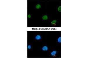 ICC/IF Image Immunofluorescence analysis of paraformaldehyde-fixed HeLa, using ZNF211, antibody at 1:200 dilution. (ZNF211 抗体)