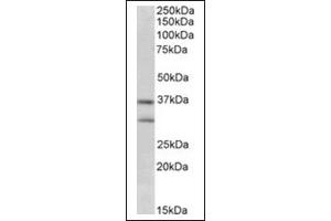 Image no. 1 for anti-Fibroblast Growth Factor 23 (FGF23) (Internal Region) antibody (ABIN375198) (FGF23 抗体  (Internal Region))