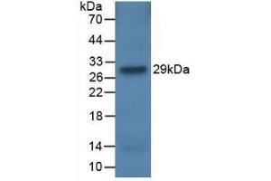 Detection of Recombinant CFH, Rat using Monoclonal Antibody to Complement Factor H (CFH) (Complement Factor H 抗体  (AA 975-1217))