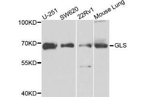 Western blot analysis of extracts of various cell lines, using GLS antibody. (Glutaminase 抗体)
