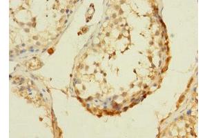 Immunohistochemistry of paraffin-embedded human testis tissue using ABIN7166755 at dilution of 1:100 (DHX32 抗体  (AA 301-500))