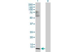 Western Blot analysis of SS18L2 expression in transfected 293T cell line by SS18L2 MaxPab polyclonal antibody. (SS18L2 抗体  (AA 1-77))