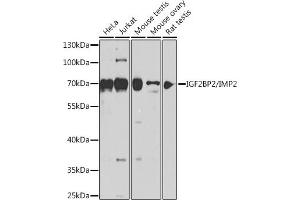 Western blot analysis of extracts of various cell lines, using IGF2BP2/IMP2 antibody (ABIN6134718, ABIN6142241, ABIN6142243 and ABIN6218347) at 1:1000 dilution. (IGF2BP2 抗体  (C-Term))