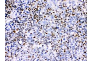 Immunohistochemistry (IHC) image for anti-IKAROS Family Zinc Finger 1 (Ikaros) (IKZF1) (AA 428-459), (C-Term) antibody (ABIN3043860)