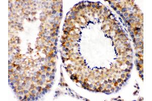 Smac/Diablo was detected in paraffin-embedded sections of mouse testis tissues using rabbit anti- Smac/Diablo Antigen Affinity purified polyclonal antibody at 1 μg/mL. (DIABLO 抗体  (AA 56-239))