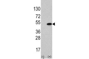 Western blot analysis of ATF4 antibody and 293 cell lysate (2 ug/lane) either nontransfected (Lane 1) or transiently transfected with the ATF4 gene (2). (ATF4 抗体  (AA 220-252))