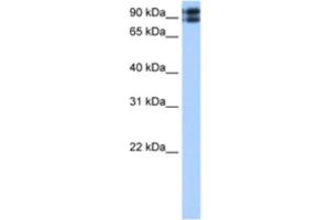 Western Blotting (WB) image for anti-C2CD2-Like (C2CD2L) antibody (ABIN2463042) (C2CD2L 抗体)