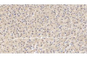 Immunohistochemistry (IHC) image for anti-Interleukin 18 Receptor 1 (IL18R1) (AA 375-428) antibody (ABIN7426325)