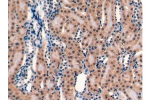 Detection of CD40L in Rat Kidney Tissue using Monoclonal Antibody to Cluster Of Differentiation 40 Ligand (CD40L) (CD40 Ligand 抗体  (AA 105-260))