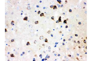 Immunohistochemistry (IHC) image for anti-Abl-Interactor 1 (ABI1) (AA 151-175), (N-Term) antibody (ABIN3043515)