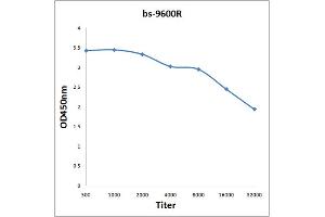 Antigen: 2 µg/100 µL  Primary: Antiserum, 1:500, 1:1000, 1:2000, 1:4000, 1:8000, 1:16000, 1:32000;  Secondary: HRP conjugated Rabbit Anti-Goat IgG at 1: 5000;  TMB staining Read the data in Microplate Reader by 450nm. (STIP1 抗体)