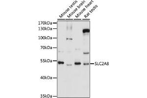 Western blot analysis of extracts of various cell lines, using SLC2 antibody (ABIN7270412) at 1:1000 dilution. (SLC2A8 抗体  (AA 200-260))