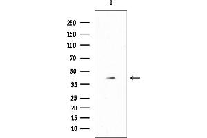 anti-WBP2 N-terminal Like (WBP2NL) (Internal Region) antibody