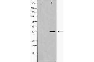 Western blot analysis of hnRPD (Phospho-Ser83) expression in 293 cell extract. (HNRNPD/AUF1 抗体  (pSer83))