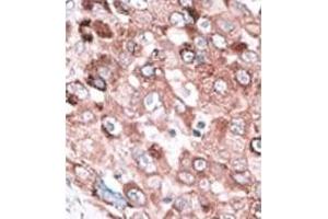 Image no. 1 for anti-BCL2-Antagonist/killer 1 (BAK1) (BH3 Domain), (N-Term) antibody (ABIN356810)