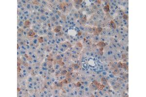 Used in DAB staining on fromalin fixed paraffin- embedded liver tissue (MYO1F 抗体  (AA 655-922))