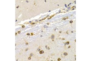 Immunohistochemistry (IHC) image for anti-Eukaryotic Translation Elongation Factor 1 delta (Guanine Nucleotide Exchange Protein) (EEF1D) (AA 1-160) antibody (ABIN3023319)
