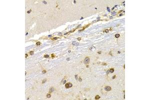 Immunohistochemistry of paraffin-embedded rat brain using EEF1D antibody (ABIN3023318, ABIN3023319, ABIN3023320 and ABIN6219589) at dilution of 1:200 (40x lens). (EEF1D 抗体  (AA 1-160))