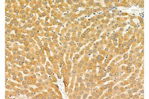 ABIN6258047 and ABIN6275822 at 1/100 staining Rat liver tissue by IHC-P.