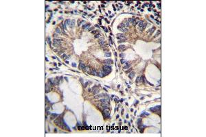 ME2 Antibody (C-term) (ABIN656541 and ABIN2845805) immunohistochemistry analysis in formalin fixed and paraffin embedded human rectum tissue followed by peroxidase conjugation of the secondary antibody and DAB staining. (NAD-ME 抗体  (C-Term))