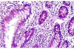 Anti-SGK223 / PRAGMIN antibody IHC staining of human colon. (PRAGMIN 抗体  (AA 2-102))