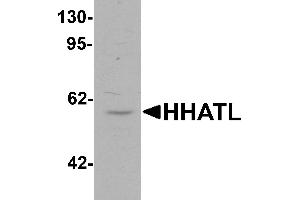 Western blot analysis of HHATL in 3T3 cell lysate with HHATL antibody at 1 µg/mL. (HHATL 抗体  (N-Term))