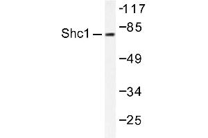 Image no. 2 for anti-SHC (Src Homology 2 Domain Containing) Transforming Protein 1 (SHC1) antibody (ABIN271910) (SHC1 抗体)