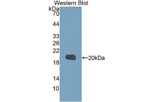 Western Blotting (WB) image for anti-Matrix Metallopeptidase 9 (Gelatinase B, 92kDa Gelatinase, 92kDa Type IV Collagenase) (MMP9) (AA 213-399) antibody (ABIN7432013)