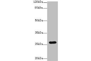 Western blot All lanes: TMEM217 antibody at 10 μg/mL + Jurkat whole cell lysate Secondary Goat polyclonal to rabbit IgG at 1/10000 dilution Predicted band size: 27, 25 kDa Observed band size: 27 kDa (TMEM217 抗体  (AA 150-211))