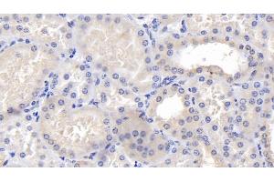 Immunohistochemistry (IHC) image for anti-Calreticulin (CALR) (AA 18-193) antibody (ABIN7433687)