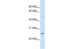 WB Suggested Anti-RNF170 Antibody Titration:  0. (RNF170 抗体  (C-Term))